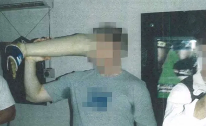 Protez Bacaktan İçki İçtiler